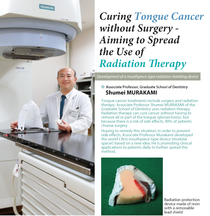 Curing Tongue Cancer without Surgery—Aiming to Spread the Use of Radiation Therapy