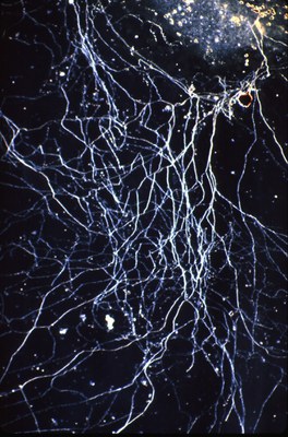 脳発達の講演会